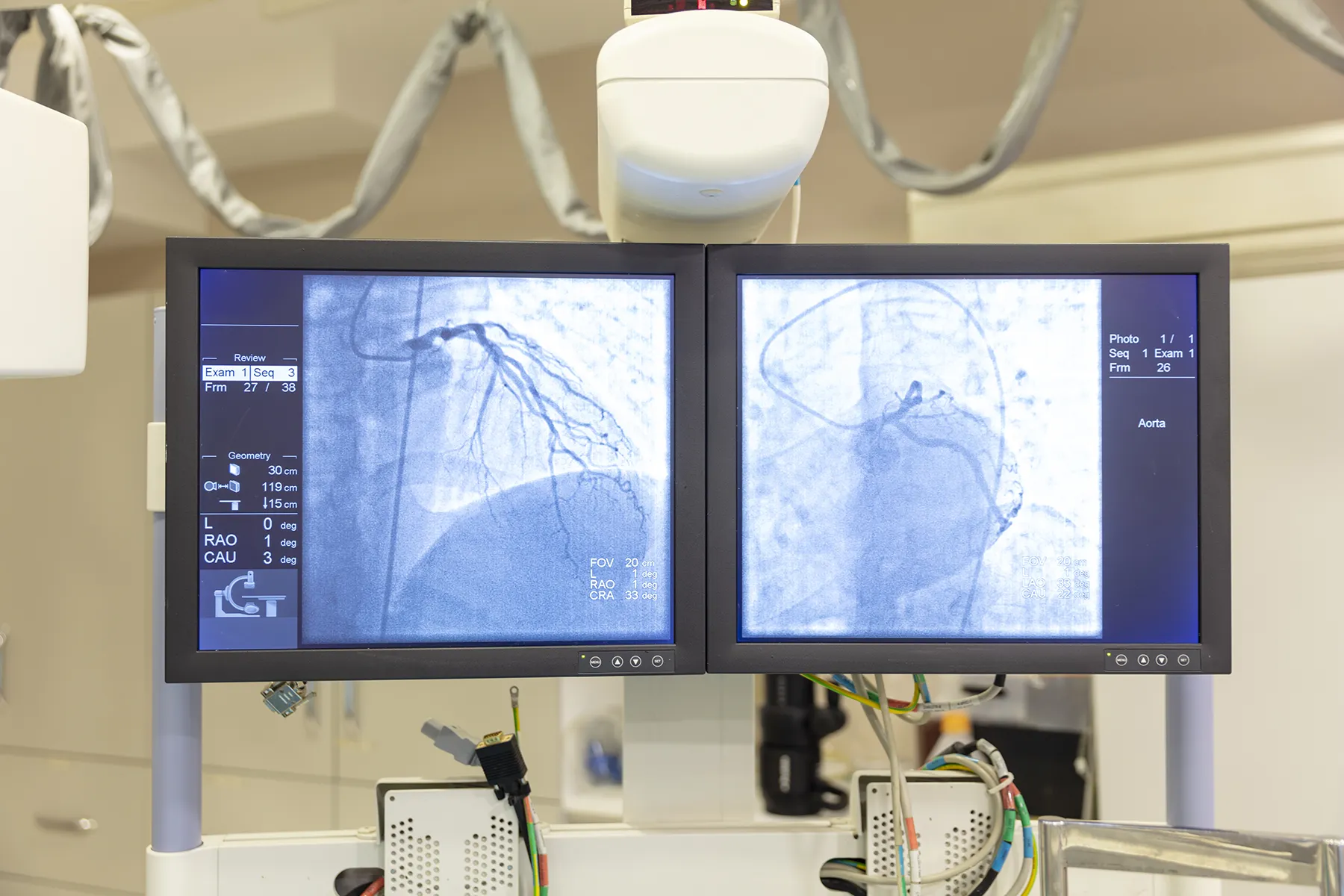 ayerkeroh cathlab-1399533076-2048x2048
