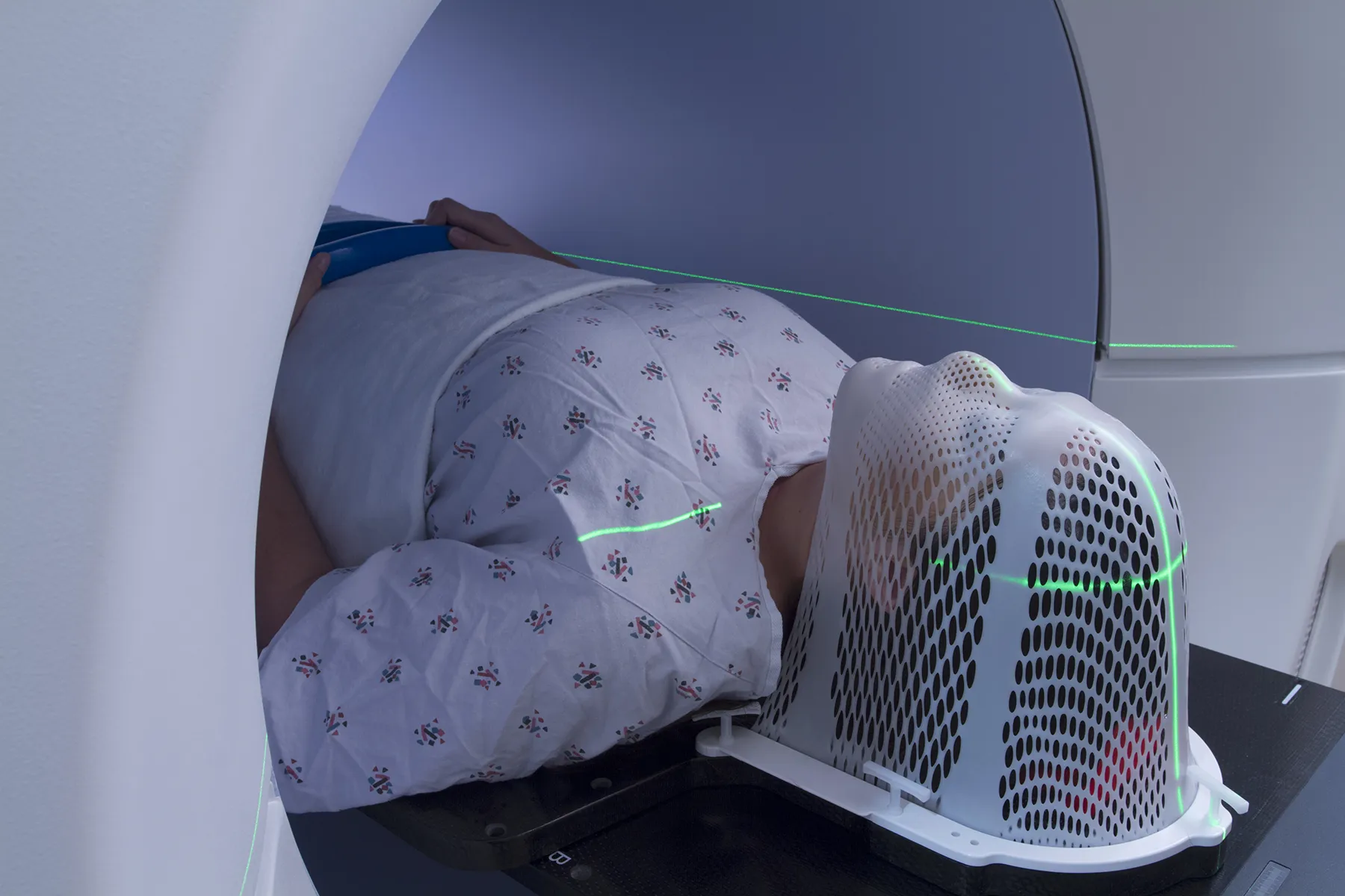 ayerkeroh Intensity Modulated Radiation Therapy (IMRT)-533196047-2048x2048