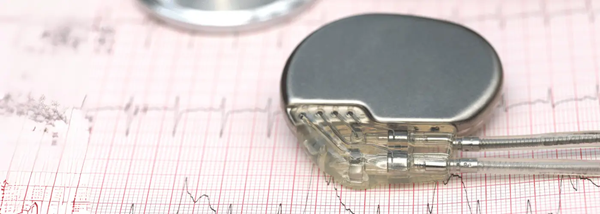 Pacemaker. What Is It